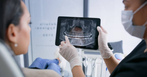 Licensed Tooth Extraction service in Fort Washington, PA - Smile Center Dentistry